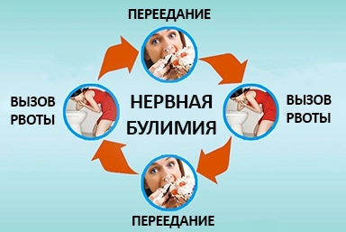 Лечение булимии в Юго-Камском